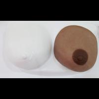 Custom Breast Prosthesis