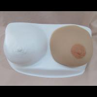 Custom Breast Prosthesis