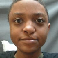 Implant retained prosthesis 