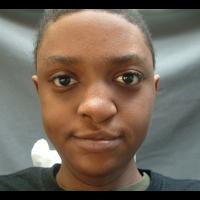 Implant retained prosthesis 